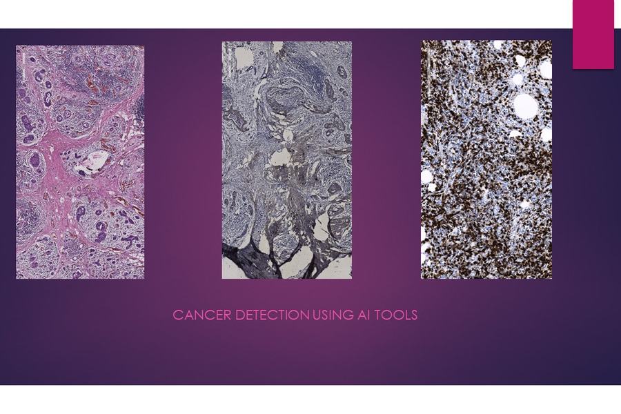 Whole-slide histopathology images used for AI biomarker prediction